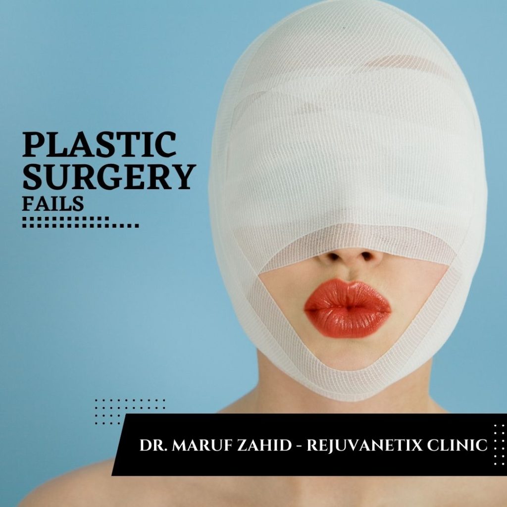 Plastic Surgery Fails, Best Plastic Surgeon in Lahore
