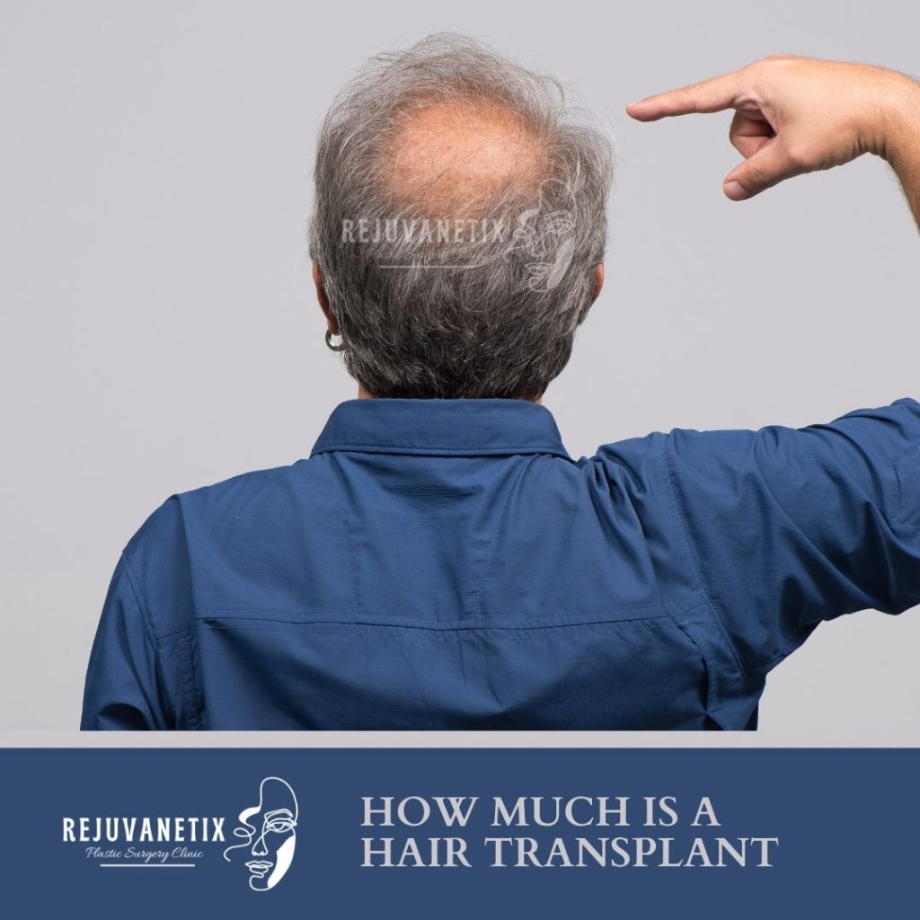 hair transplant, hair transplant cost in Lahore, best hair transplant doctors in Lahore, hair transplant before and after photos, hair transplant recovery time, hair transplant risks, hair transplant success rate, hair transplant FAQs, hair transplant financing, hair transplant